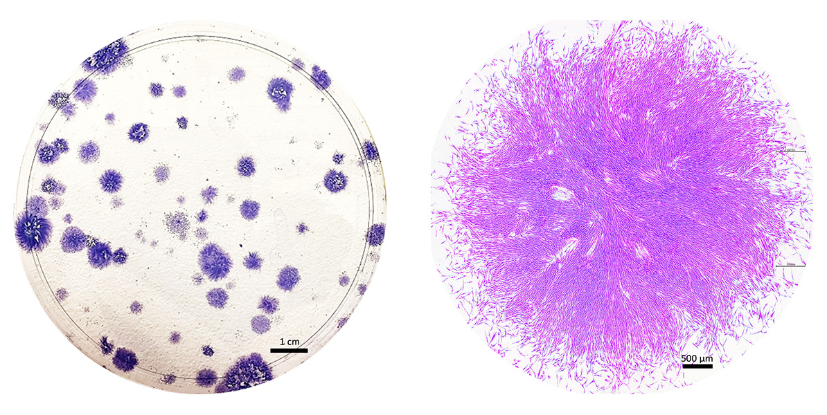 Stem cells derived from menstrual fluid, shown at different magnifications.